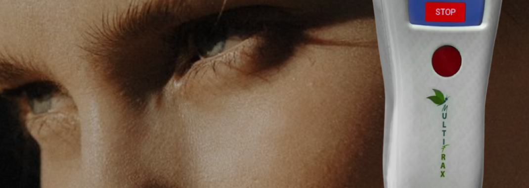 Darstellung des neuen MultiFrax Lasers vor einem weiblichen Gesicht